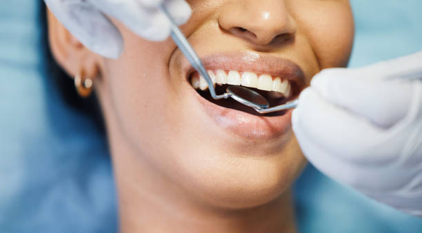 Best Emergency Dental Care for Sports Injuries in Vandercook Lake, MI
