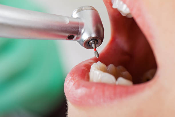 Best Emergency Dental Care for Sports Injuries in Vandercook Lake, MI